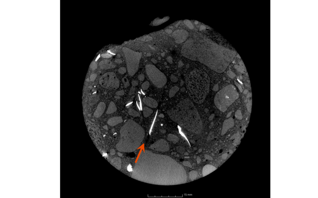 杯狀偽影與條紋偽影