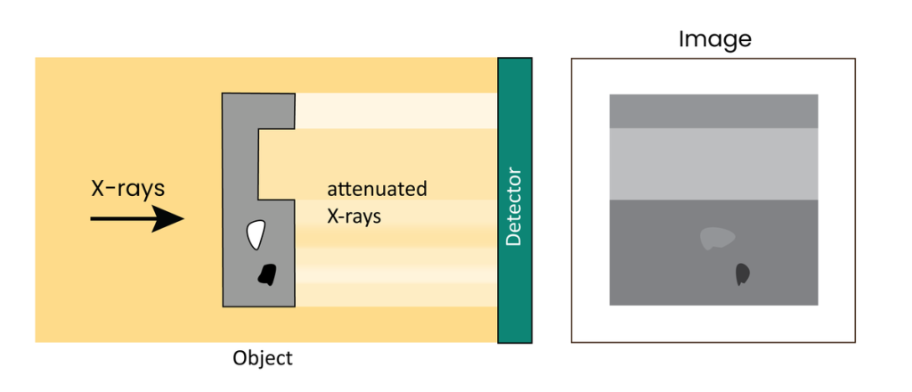 傳統(tǒng)X射線照片