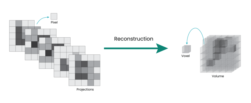 計(jì)算機(jī)斷層掃描