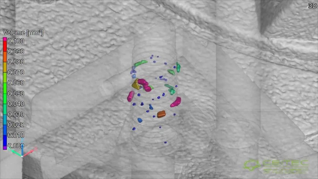 放大視圖展示了螺紋區(qū)域內(nèi)檢測到的微小雜質(zhì)，以不同顏色標(biāo)示其體積與分布，支持材料安全性分析。