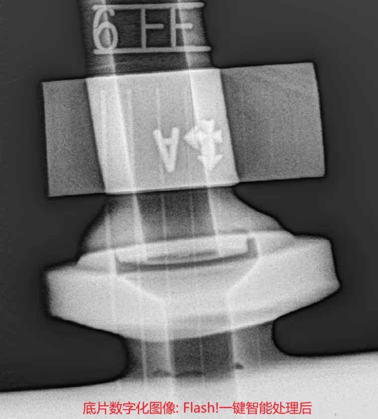 底片數(shù)字化圖像經(jīng)過(guò)Flash! 一鍵智能處理后的效果圖，細(xì)節(jié)清晰，對(duì)比度增強(qiáng)。