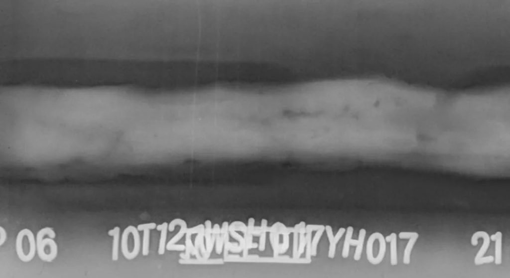 焊縫工業(yè)射線底片原始圖像，用于展示FS50B 掃描儀的高分辨率數(shù)字化效果。