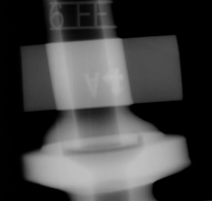 工業(yè)零件射線底片數(shù)字化原始圖像，顯示未經(jīng)過(guò)Flash! 智能處理前的檢測(cè)畫面。